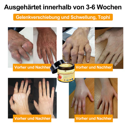 ✅ Offizieller Shop:  Bienengift-Schmerzlinderungs Knochenheilungs Creme 👨‍⚕️(BfArM) zertifiziert(Reduzierung von Gelenkschwellungen, Schmerzen, Steifheit, Rötungen, Wärme, Muskelkater und Gelenkmüdigkeit)