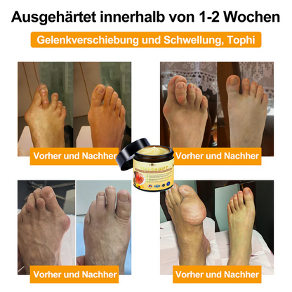 ✅ Offizieller Shop:  Bienengift-Schmerzlinderungs Knochenheilungs Creme 👨‍⚕️(BfArM) zertifiziert(Reduzierung von Gelenkschwellungen, Schmerzen, Steifheit, Rötungen, Wärme, Muskelkater und Gelenkmüdigkeit)